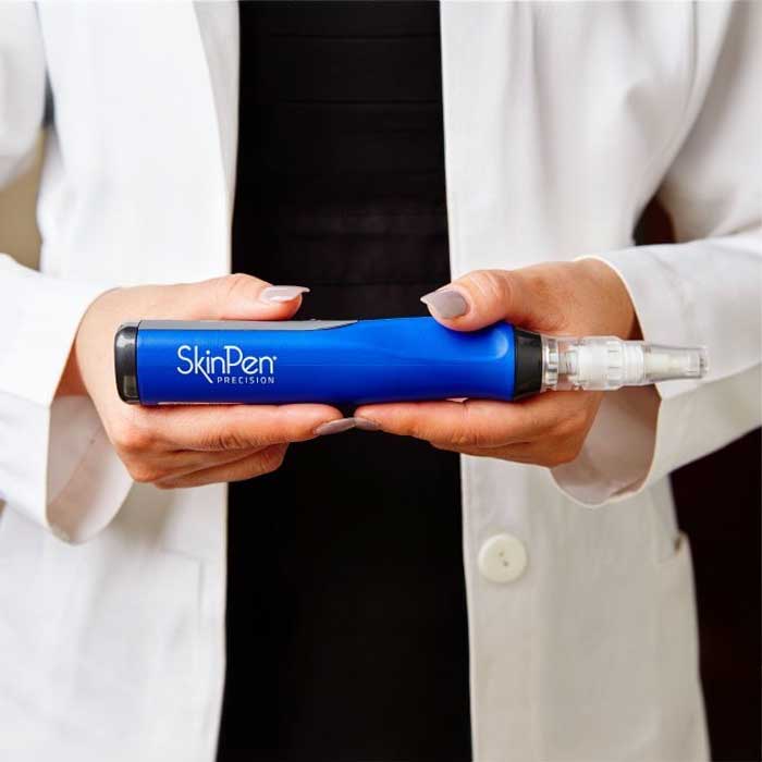 skinpen kezeles